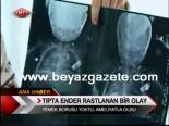 Tıpta Ender Rastlanan Bir Olay
