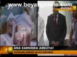 Ana Karnında Ameliyat