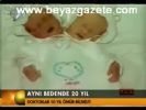 Aynı Bedende 20 Yıl