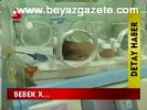 Bebek X...