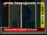 Obama'nın Dudağı Patladı