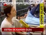 Sistem De Kanser Oldu