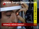 Kırmızı Göze Dikkat...