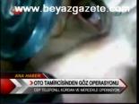 Oto Tamircisinden Göz Operasyonu