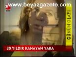 30 Yıldır Kanayan Yara