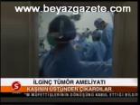 İlginç Tümör Ameliyatı