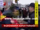 Başkomiserin Kopan Parmağı