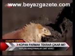 Kopan Parmak Tekrar Çıkar Mı?