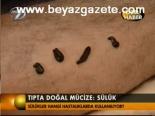 Tıpta Doğal Mucize: Sülük