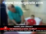 Yanıklara Dikkat!