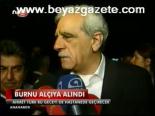 Burnu Alçıya Alındı
