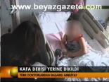 Kafa Derisi Yerine Dikildi