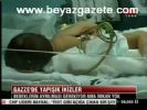 Gazze'de Yapışık İkizler