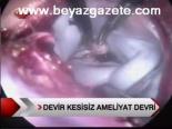 Devir Kesisiz Ameliyat Devri
