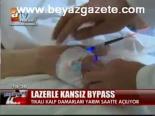 Lazerle Kansız Bypass