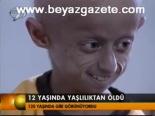 12 Yaşında Yaşlılıktan Öldü