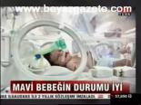 Mavi Bebeğin Durumu İyi