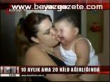 10 Aylık Ama 20 Kilo