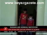 Dudakları Sürekli Büyüyor