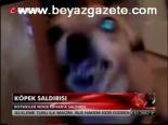 Köpek Saldırısı