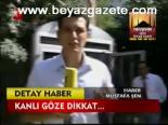 Kanlı Göze Dikkat