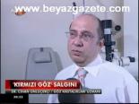 Kırmızı Göz Salgını