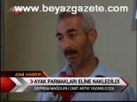 Ayak Parmakları Eline Nakledildi
