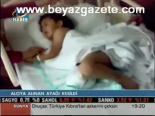 Alçıya Alınan Ayağı Kesildi