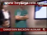 Gamze'den Bacağını Aldılar!