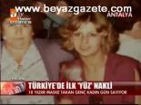 Türkiye'de İlk Yüz Nakli