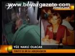 Yüz Nakli Olacak