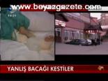 Yanlış Bacağı Kestiler