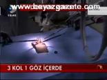 3 Kol 1 Göz İçerde