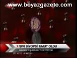 Sıvı Biyopsi Umut Oldu
