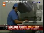 Göbekten Obezite Ameliyatı!