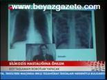 Silikolizs Hastalığına Önlem
