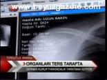 Organları Ters Taraftar