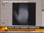 Hasta Avuç İçinde Tanınacak
