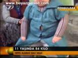 11 Yaşında 84 Kilo
