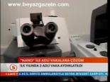 'Nano' İle Adli Vakalara Çözüm