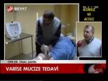 Varise Mucize Tedavi