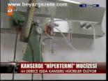 Kanserde Hipertermi Mucizesi