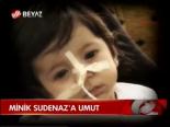 Minik Sudenaz'a Umut