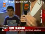 Ameliyatta Cam Skandalı