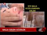 Balla Gelen Güzellik