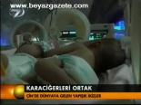 Karaciğerleri Ortak