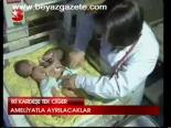 Ameliyatla Ayrılacaklar