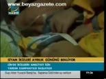 Siyam İkizleri Ayrılık Günün Bekliyor