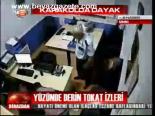 Yüzünde Derin Tokat Haberiri