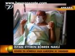 İsyan Ettiren Böbrek Nakli